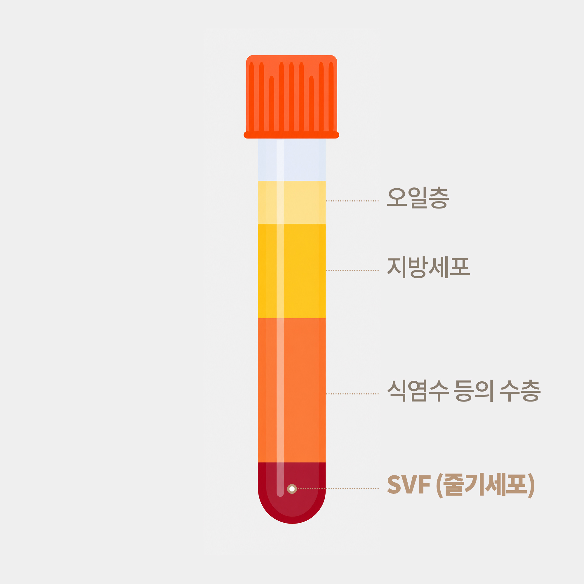 기질혈관분획 SVF 추출
