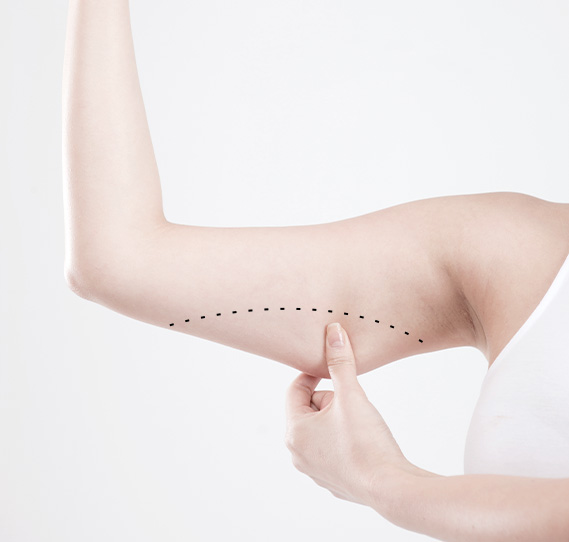 수술 전 디자인