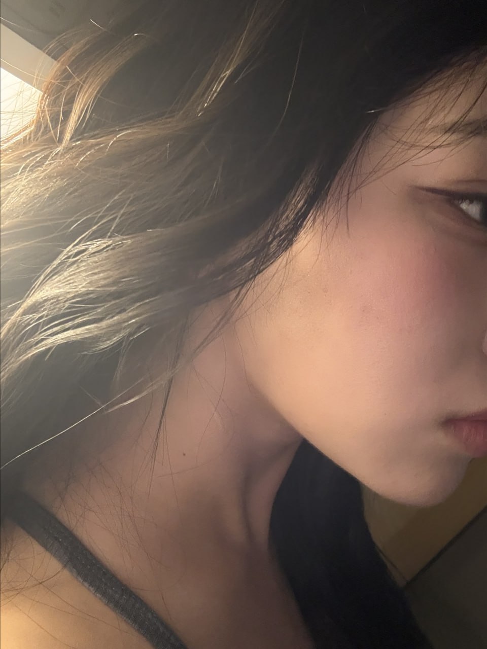 얼굴 지방이식 이미지 1